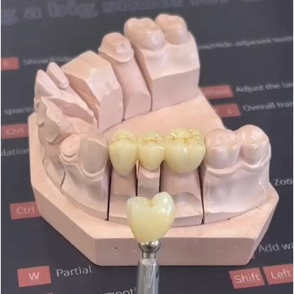 500g iFun Temporary Crown Resin Biocompatible Dental 3D printing resin